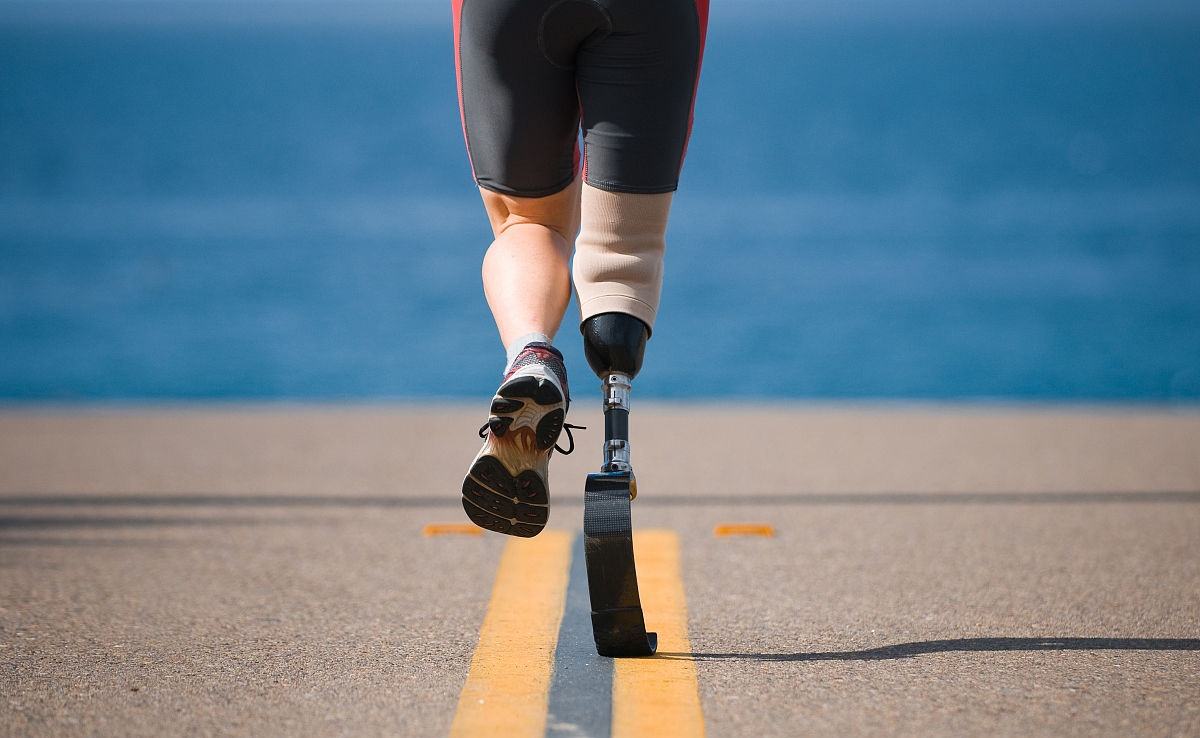 小腿假肢價格是多少及日常護理方法(圖1) 小腿假肢價格是多少及日常護理方法(圖1)