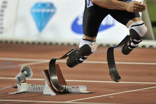 假肢價格的形成需要經(jīng)過哪三個環(huán)節(jié)?(圖1) 假肢價格